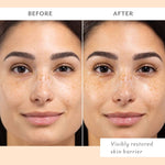 Comparison of a woman face before and after skincare treatment showing skin texture improvement