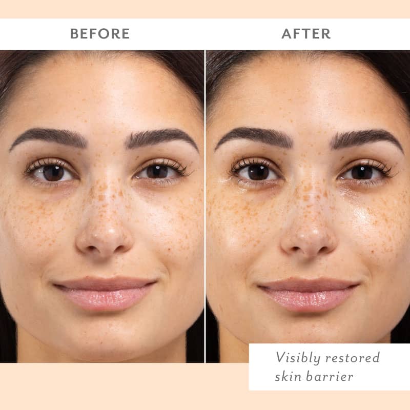 Comparison of a woman face before and after skincare treatment showing skin texture improvement
